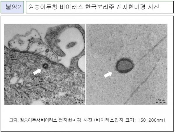 원숭이두창 바이러스 한국분리주 전자현미경 사진=질병관리청 