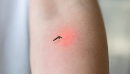 국내에서도 매년 말라리아가 늘고 있기에 모기에 물리지 않도록 각별히 주의해야 한다.