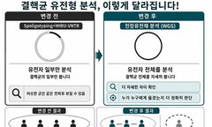 1만7천 결핵환자 잡는다…질병청, WGS로 감염경로 '게임 체인저' 도입
