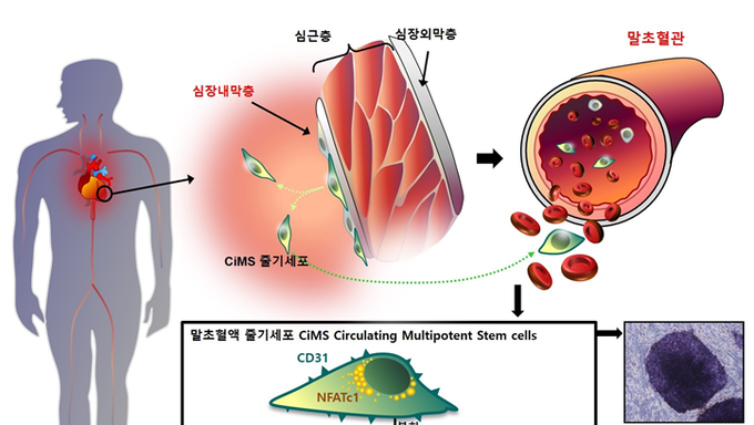혈액 채취해 줄기세포 만든다