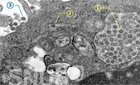 코로나19 확진자 있는 도시는: 서울 대구 인천 광주 제주, 도는: 경기 충북 충남 전북 전남 경북 경남