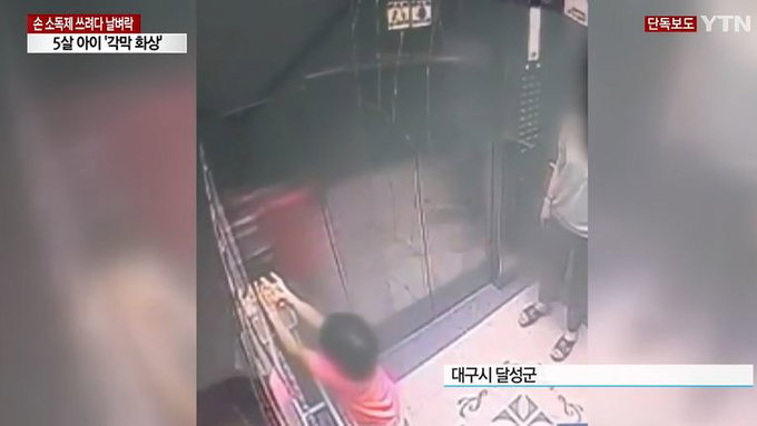 5살 아이 손소독 하려다 각막 화상 입어