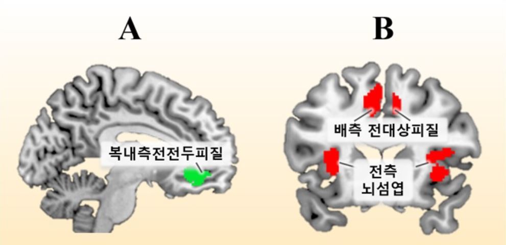 brain