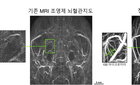 IBS과 연세대 최병욱 교수팀, '가돌리늄' 대신 철분제 사용한 MRI 조영제 개발