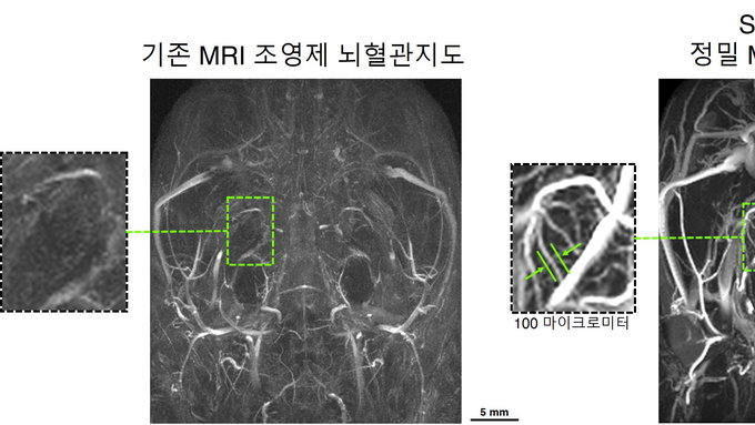IBS과 연세대 최병욱 교수팀, '가돌리늄'  대신 철분제 사용한 MRI 조영제 개발