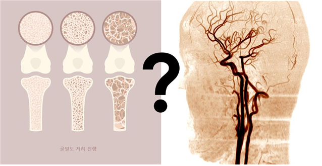 bone