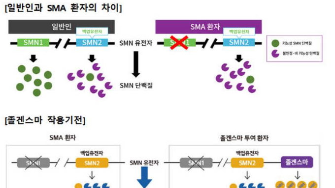 1회 투여 25억원 신약 '졸겐스마주' 국내 허가