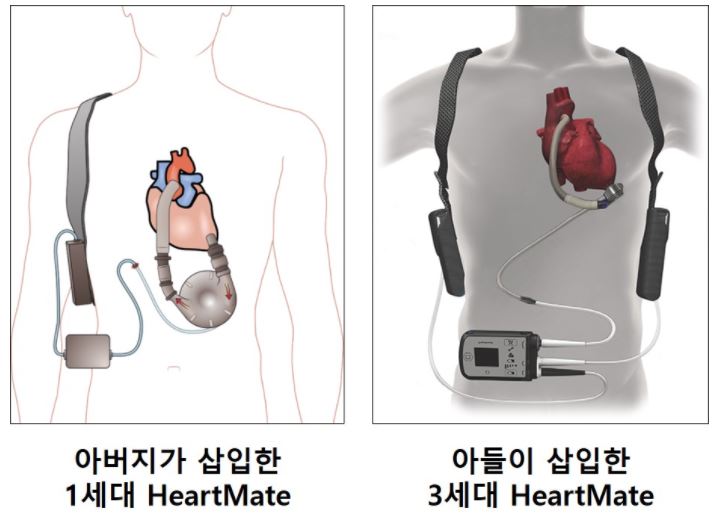 heart