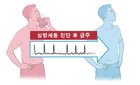 심방세동 환자, 금주하면 뇌졸중 위험도 낮춘다