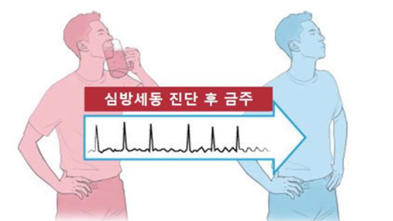 심방세동 환자, 금주하면 뇌졸중 위험도 낮춘다