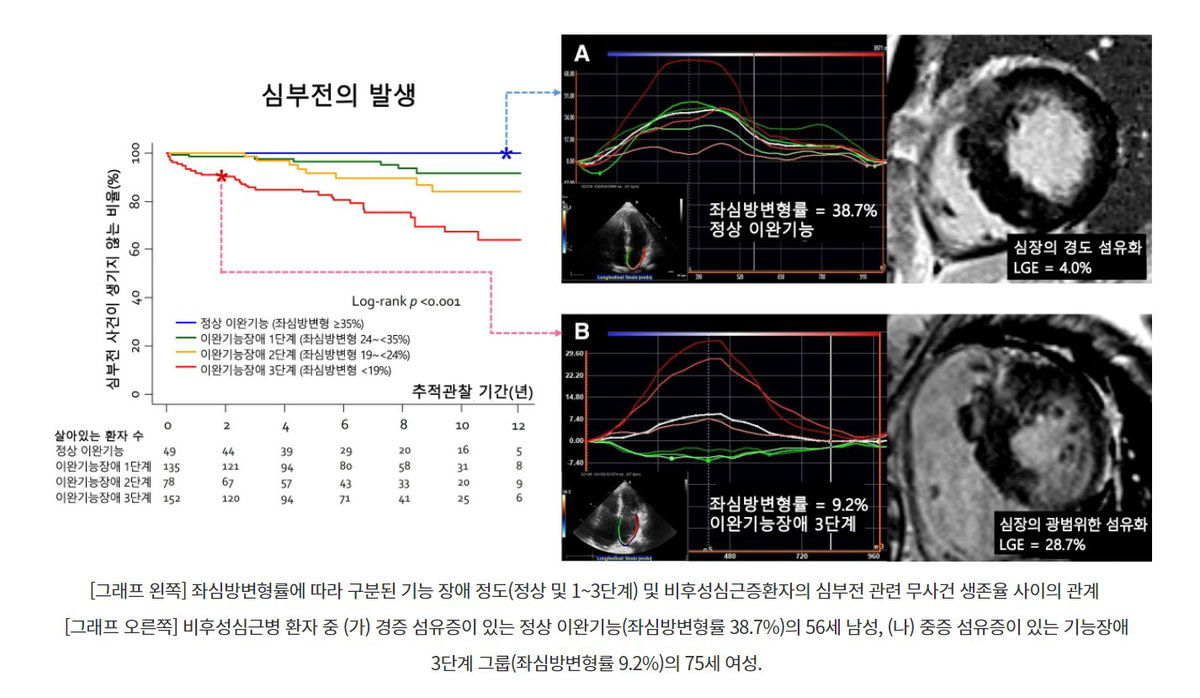 [그래프 왼쪽] 좌심방변형률에 따라 구분된 기능 장애 정도(정상 및 1~3단계) 및 비후성심근증환자의 심부전 관련 무사건 생존율 사이의 관계  [그래프 오른쪽] 비후성심근병 환자 중 (가) 경증 섬유증이 있는 정상 이완기능(좌심방변형률 38.7%)의 56세 남성, (나) 중증 섬유증이 있는 기능장애 3단계 그룹(좌심방변형률 9.2%)의 75세 여성.