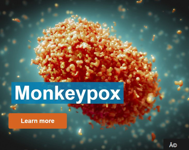 원숭이두창 monkeypox =WHO 이미지 