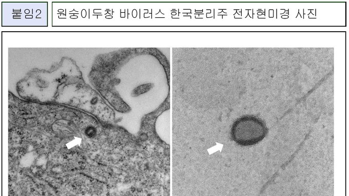 질병관리청 원숭이두창 바이러스 분리 성공, 유전정보 공개
