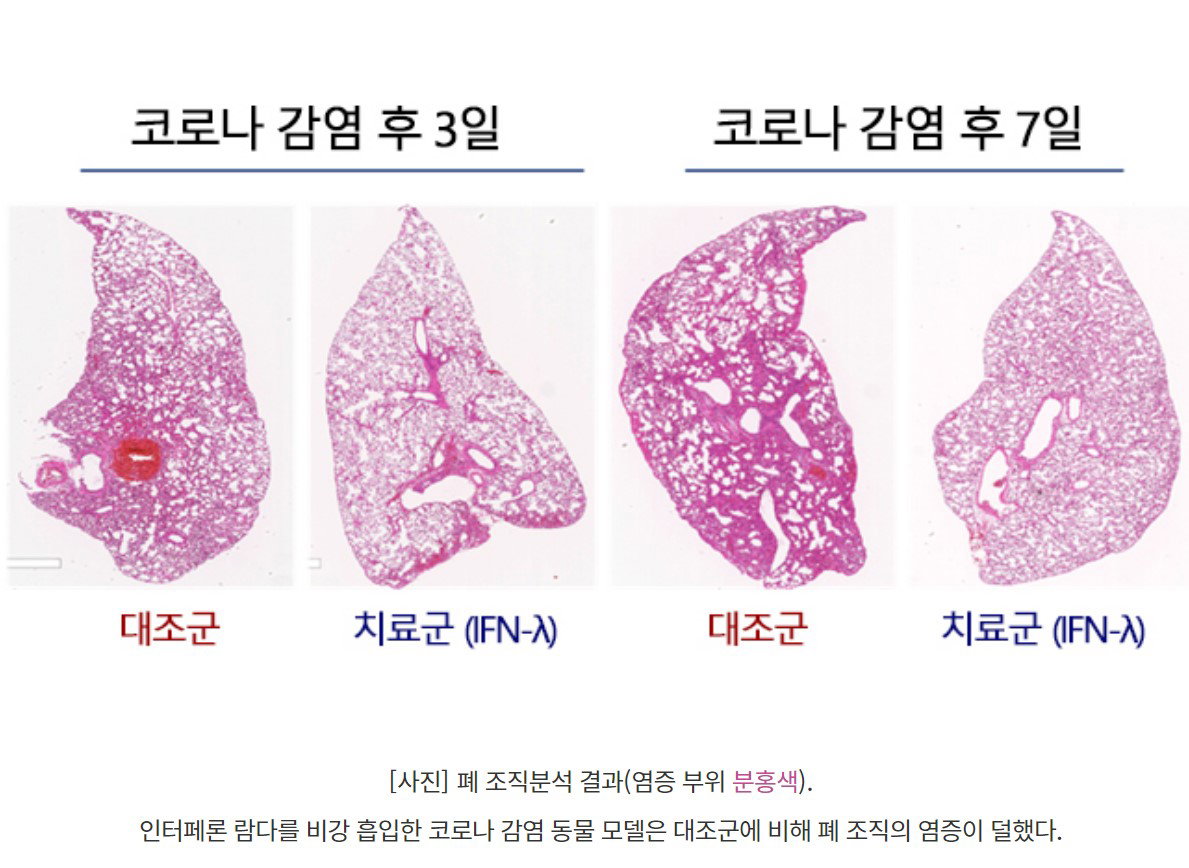[사진] 폐 조직분석 결과(염증 부위 분홍색). 인터페론 람다를 비강 흡입한 코로나 감염 동물 모델은 대조군에 비해 폐 조직의 염증이 덜했다. =서울대병원 