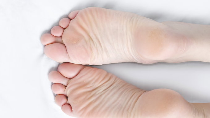 샌들 신는데 뒷꿈치 각질 신경 쓰인다면