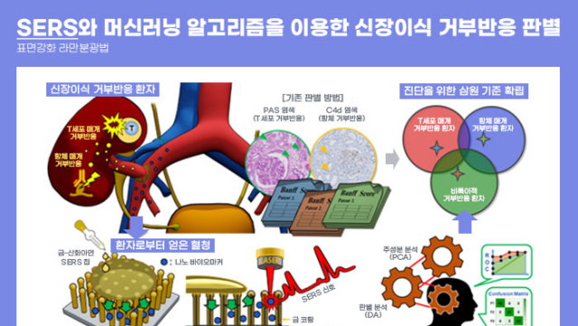 피 한 방울로 신장이식 거부반응 조기 진단 가능해져