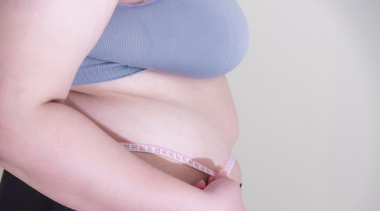 비만, 환자의 의지만으로는 치료 어려워