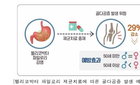 "헬리코박터 제균 치료, 골다공증 위험 29%↓ 효과"