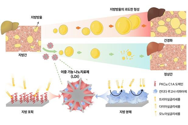 나노치료제의 이중 기능을 통한 지방간 개선