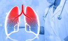 COPD 환자, 코로나19 완치 후가 더 위험… 사망 위험 1.8배↑