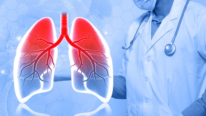 "담배 안 피워도 위험"… 만성폐쇄성폐질환(COPD), 기대수명 최대 7.1년 단축