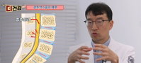 스마트폰이 부른 '사지마비' 경추척수증 경고