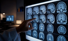MRI vs CT: 명확한 차이와 선택 가이드