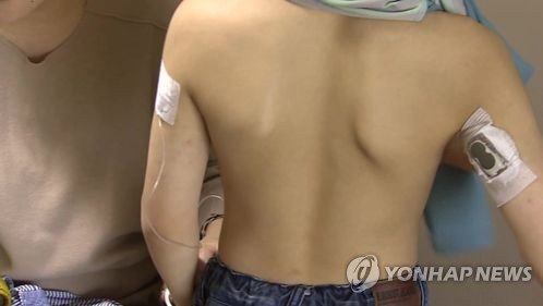 '5배 급증' 소아청소년 당뇨, 첫 국가 레지스트리로 예방·치료 전환점
