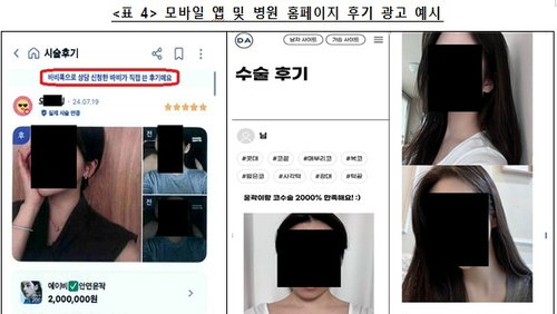 7년 꼼수 '뒷광고' 성형외과 3곳, 공정위 철퇴…의료계 경종