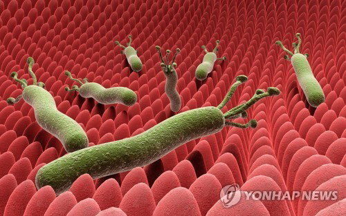 헬리코박터균 제균, 대장암 34%↓·사망 49%↓ '새 전기'