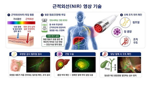 4배 오래가는 형광염료 'KR-NIR-P' 개발…암 수술 정밀도 혁신