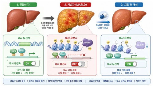 지방간 ‘유전자 스위치’ 규명…새 치료표적 열쇠 쥐다
