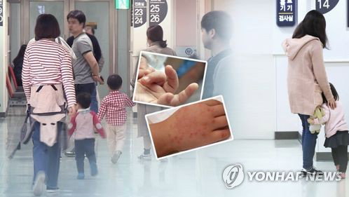 질병관리청 경고: 수족구병 석 달 만에 33배 폭증…'아프면 등원 금지'