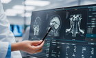 뇌 MRI 한 장으로 뇌종양 유전자 변이 예측… 판독문까지 쓰는 의료 AI 나왔다